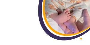 Signs and Symptoms of Clubfoot